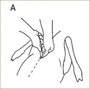 Field Dressing Example 1